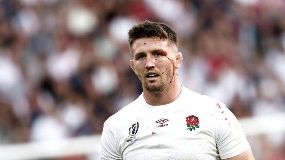 England's Curry cautious over rugby return after hip surgery