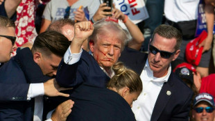 Bloodied Trump survives assassination bid