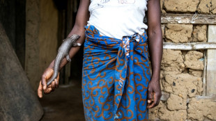 On the front line in Liberia's fight to save the pangolin