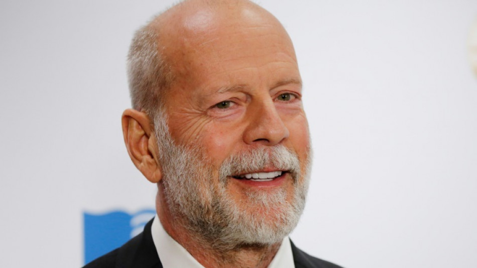 Bruce Willis es diagnosticado con demencia