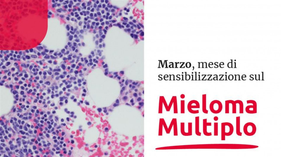 Mese sensibilizzazione mieloma multiplo, migliora sopravvivenza