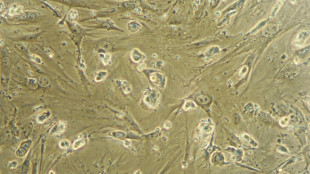 Científicos japoneses logran avances en lesiones medulares con un tratamiento de células madre