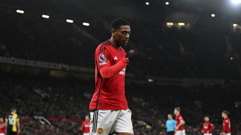 Manchester United's Martial out for 10 weeks