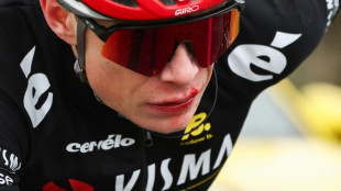 Vingegaard reveals concussion from Paris-Nice fall